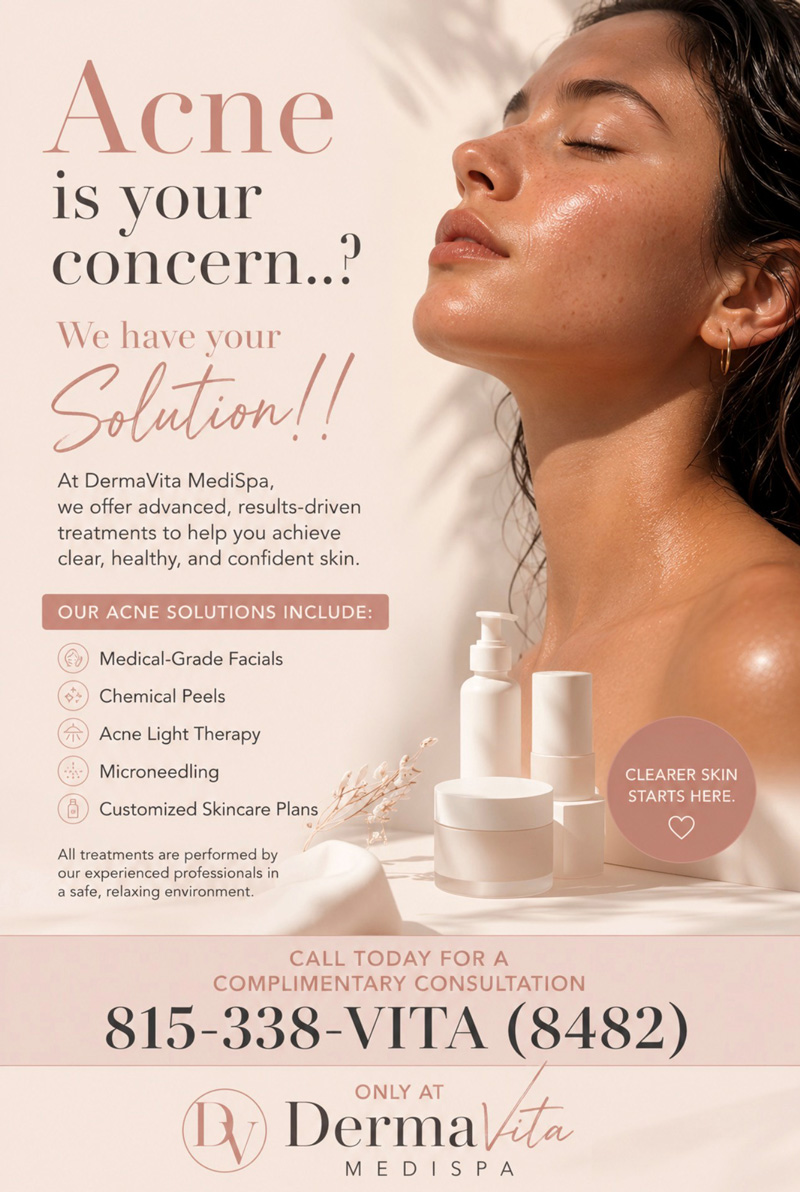 Acne Peel Email Blast 2026